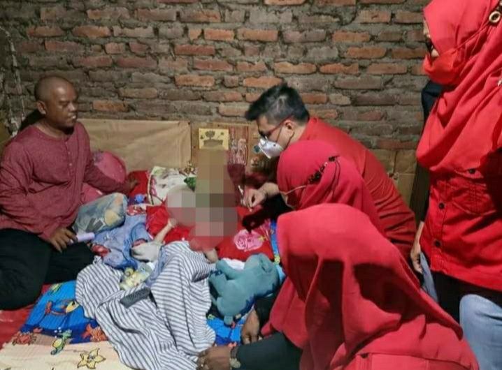 John Thamrun Bersama PAC PDI-P Lakarsantri Kunjungi Balita Penderita Hydrocepalus